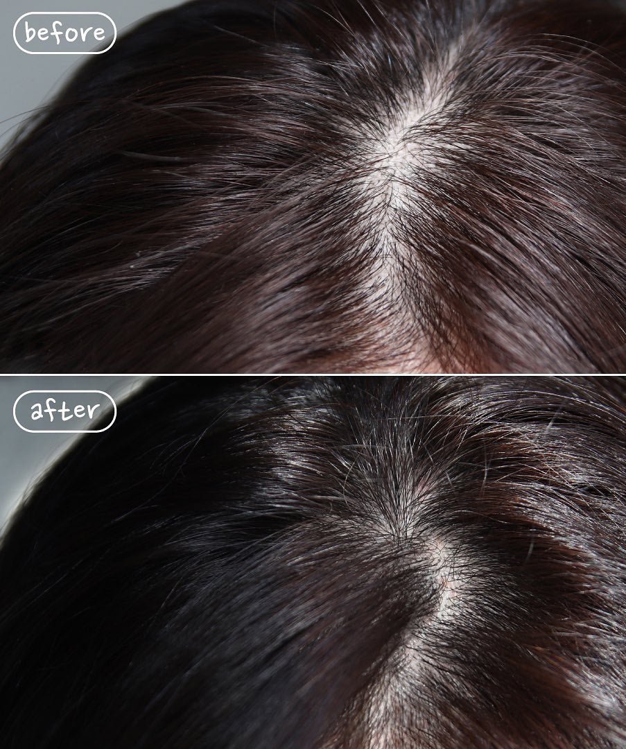 Black Bean Anti Hair Loss Treatment - Nature Republic